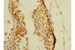 Immunohistochemistry of paraffin-embedded human testis tissue using ABIN7160526 at dilution of 1:100 (PDE4DIP antibody  (AA 1-310))