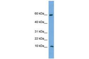 Image no. 1 for anti-Chromosome 20 Open Reading Frame 144 (C20orf144) (C-Term) antibody (ABIN6743651) (C20orf144 antibody  (C-Term))