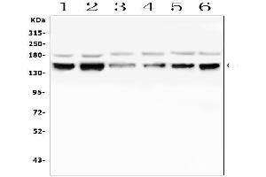 Western blot analysis of RAB3GAP2 using anti-RAB3GAP2 antibody (ABIN6719633).
