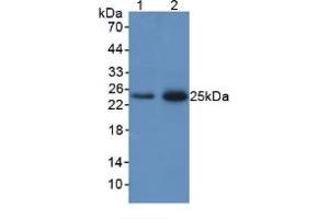 Figure. (Lipocalin 2 antibody  (AA 21-198))