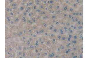 Detection of PLA2R1 in Mouse Liver Tissue using Polyclonal Antibody to Phospholipase A2 Receptor 1 (PLA2R1)