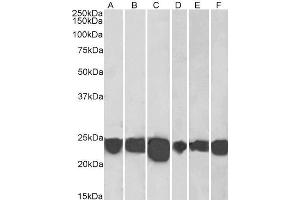 Western Blotting (WB) image for anti-Parkinson Protein 7 (PARK7) (C-Term) antibody (ABIN184951)