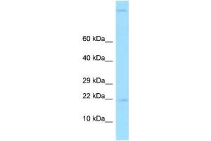 WB Suggested Anti-GKN2 Antibody Titration: 1. (Gastrokine 2 antibody  (N-Term))