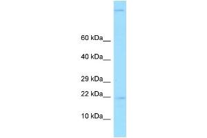 WB Suggested Anti-GKN2 Antibody Titration: 1.