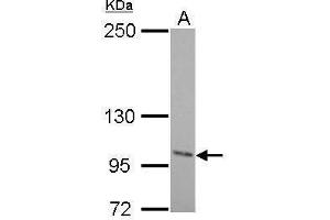 ENPP2 Antikörper  (C-Term)