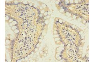 Immunohistochemistry of paraffin-embedded human small intestine tissue using ABIN7170961 at dilution of 1:100 (SULT1B1 antibody  (AA 1-271))