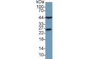 Detection of PRDX6 in Mouse Liver lysate using Polyclonal Antibody to Peroxiredoxin 6 (PRDX6) (Peroxiredoxin 6 antibody  (AA 1-224))