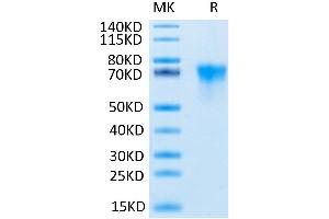 Human FGFR3 alpha (IIIb) on Tris-Bis PAGE under reduced conditions.