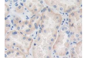 DAB staining on IHC-P; Samples: Human Kidney Tissue (TRAF4 antibody  (AA 193-444))
