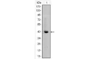 Western Blot showing CTNNB1 antibody used against CTNNB1-hIgGFc transfected HEK293 cell lysate. (CTNNB1 antibody)