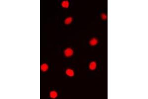 Immunofluorescent analysis of Cyclin E1 staining in PC12 cells. (Cyclin E1 antibody  (Center))