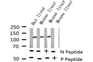 Western Blotting (WB) image for anti-Epidermal Growth Factor Receptor (EGFR) (pSer695) antibody (ABIN6255471)