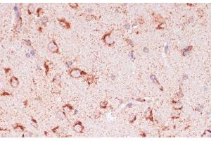 Immunohistochemistry of paraffin-embedded Rat brain using ENTPD6 Polyclonal Antibody at dilution of 1:100 (40x lens). (ENTPD6 antibody)