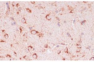 Immunohistochemistry of paraffin-embedded Rat brain using ENTPD6 Polyclonal Antibody at dilution of 1:100 (40x lens). (ENTPD6 antibody)