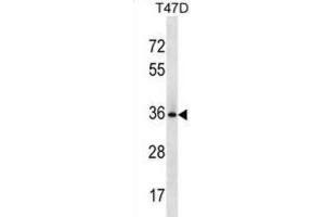Western Blotting (WB) image for anti-BCL2-Like 12 (Proline Rich) (BCL2L12) antibody (ABIN3000719) (BCL2L12 antibody)
