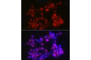 Immunofluorescence analysis of LNCaP cells using NKX3. (NKX3-1 antibody)