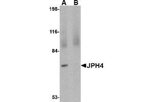 Western Blotting (WB) image for anti-Junctophilin 4 (JPH4) (C-Term) antibody (ABIN1030461) (Junctophilin 4 antibody  (C-Term))