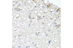Immunohistochemistry of paraffin-embedded rat brain using METTL13 antibody at dilution of 1:100 (x40 lens). (METTL13 antibody)
