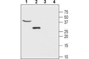 Chloride Intracellular Channel 5 (CLIC5) peptide