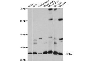 Western blot analysis of extracts of various cell lines, using PSMB7 antibody.
