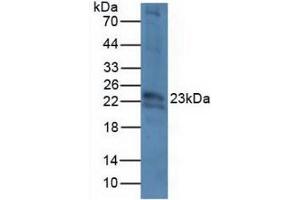 Figure. (CRYbB2 antibody  (AA 17-191))