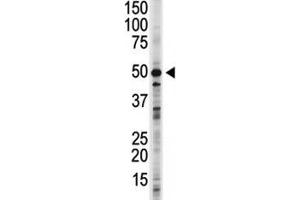 GSK3B antibody used in western blot to detect GSK3B in 293 cell lysate. (GSK3 beta antibody  (AA 4-34))