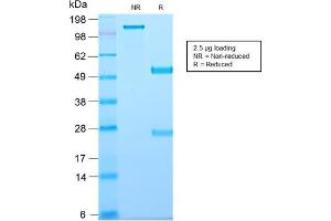 SDS-PAGE Analysis Purified CD81 Rabbit Recombinant Monoclonal Antibody (C81/2885R). (Recombinant CD81 antibody)
