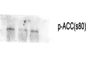 Western Blot (WB) analysis: Please contact us for more details. (Acetyl-CoA Carboxylase alpha antibody  (pSer80))