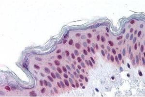 Human Skin: Formalin-Fixed, Paraffin-Embedded (FFPE) (RUVBL2 antibody  (AA 304-458))