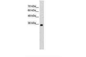 Image no. 2 for anti-Zinc Finger, MYND-Type Containing 11 (ZMYND11) (AA 138-187) antibody (ABIN203315) (ZMYND11 antibody  (AA 138-187))