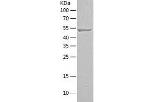 Western Blotting (WB) image for Proteasome (Prosome, Macropain) 26S Subunit, Non-ATPase, 5 (PSMD5) (AA 1-504) protein (His tag) (ABIN7124616) (PSMD5 Protein (AA 1-504) (His tag))