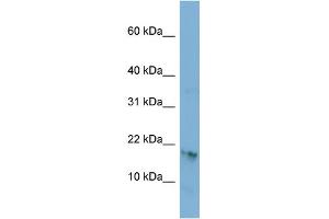 WB Suggested Anti-C17orf64 Antibody Titration: 0. (C17orf64 antibody  (Middle Region))