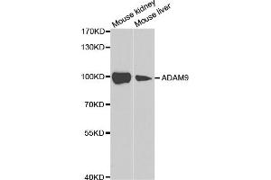 Western blot analysis of extracts of various cell lines, using ADAM9 antibody (ABIN5973121) at 1/1000 dilution. (ADAM9 antibody)