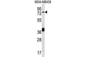 CEL Antibody (Center) western blot analysis in MDA-MB435 cell line lysates (35µg/lane). (Cholesterol Esterase antibody  (Middle Region))