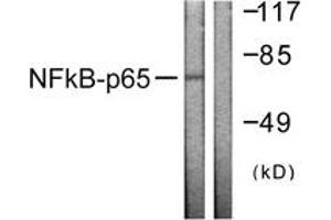 Western blot analysis of extracts from HeLa cells, using NF-kappaB p65 (Ab-505) Antibody. (NF-kB p65 antibody  (AA 471-520))