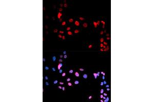 Immunofluorescence analysis of U2OS cell using Phospho-MAX-S11 antibody. (MAX antibody  (pSer11))