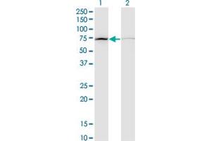 Western Blot analysis of DAB2 expression in transfected 293T cell line by DAB2 monoclonal antibody (M09), clone 3D6. (DAB2 antibody  (AA 1-770))