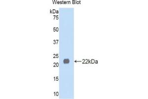 Western blot analysis of the recombinant protein. (LEFTY1 antibody  (AA 167-332))