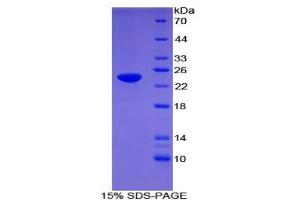 SDS-PAGE analysis of Human Apolipoprotein F Protein. (Apolipoprotein F Protein (APOF))