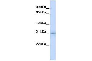 METTL5 antibody used at 1 ug/ml to detect target protein. (METTL5 antibody  (N-Term))