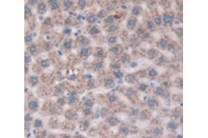 Used in DAB staining on fromalin fixed paraffin- embedded Kidney tissue (CD109 antibody  (AA 719-965))