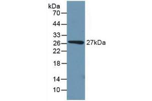 Detection of Recombinant PCK1, Mouse using Polyclonal Antibody to Phosphoenolpyruvate Carboxykinase 1, Soluble (PCK1) (PCK1 antibody  (AA 312-563))