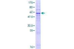 SFXN1 Protein (AA 1-322) (GST tag)