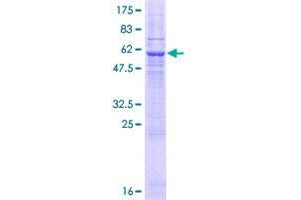 SFXN1 Protein (AA 1-322) (GST tag)