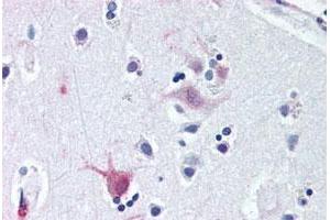 Immunohistochemical staining of human brain, cortex with WNT8B polyclonal antibody . (WNT8B antibody  (C-Term))
