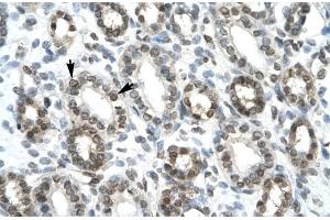 Rabbit Anti-HEY1 Antibody ,Paraffin Embedded Tissue: Human Kidney  Cellular Data: Epithelial cells of renal tubule  Antibody Concentration: 4. (HEY1 antibody  (C-Term))