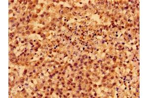 Immunohistochemistry (IHC) image for anti-SMAD Family Member 4 (SMAD4) (AA 27-195) antibody (ABIN7160238)