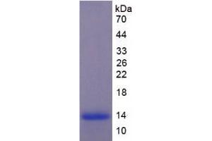 SDS-PAGE analysis of Mouse Melatonin Receptor 1A Protein. (Melatonin Receptor 1A Protein (MTNR1A))