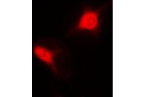 Immunofluorescent analysis of Sm-D2 staining in MCF7 cells. (SNRPD2 antibody)