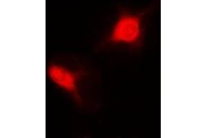 Immunofluorescent analysis of Sm-D2 staining in MCF7 cells. (SNRPD2 antibody)